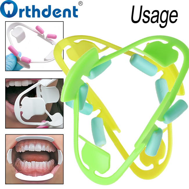 3D Oral Dental Mouth Opener Lip Retractor Intraoral Orthodontic Expander