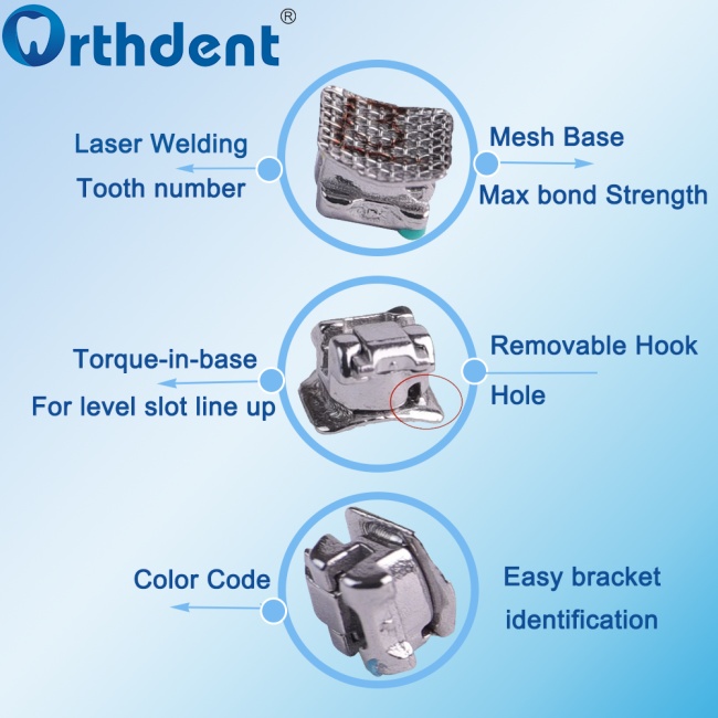 Self-Ligating Braces: State-Of-the-Art Orthodontics