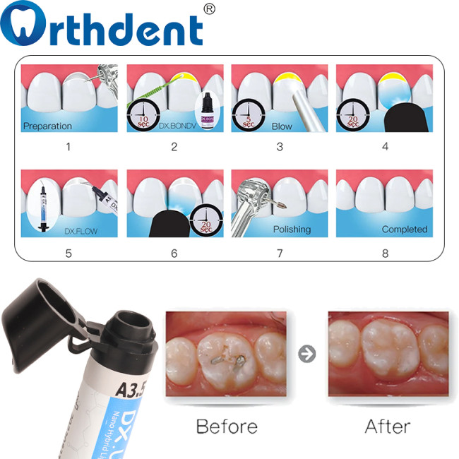 Dental DENTEX Light Cure Resin Bonding Universal & Esthetic Composite Kit