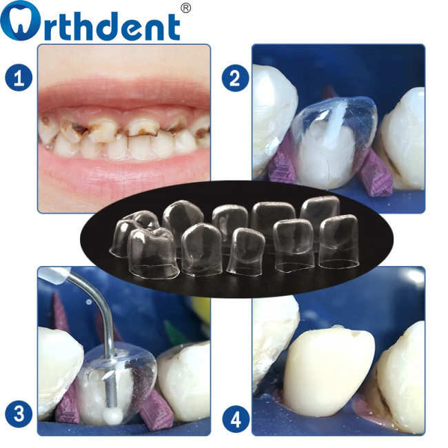 64Pcs Transparent Temporary Preformed Crowns Adult/Child Anterior Postduous Transparent Deciduous
