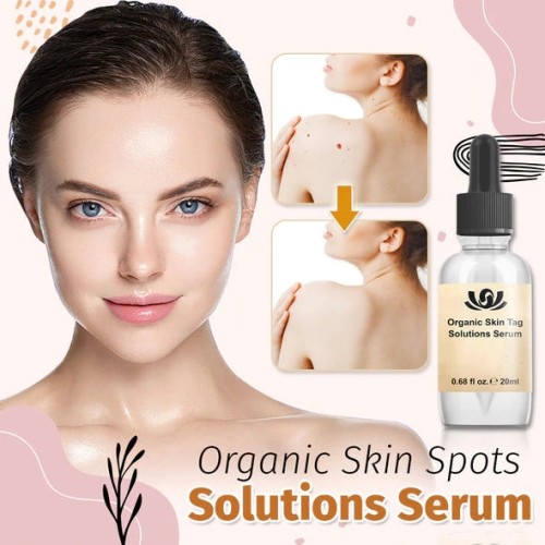 Organic Skin Spot Solutions Serum-[HOT SALE-45%OFF🔥]-UD046