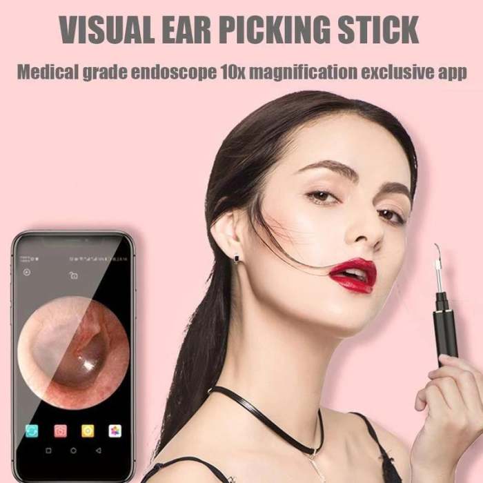 (🌲Early Christmas Sale- SAVE 50% OFF)-WiFi visible wax elimination spoon, USB 1080P HD load otoscope