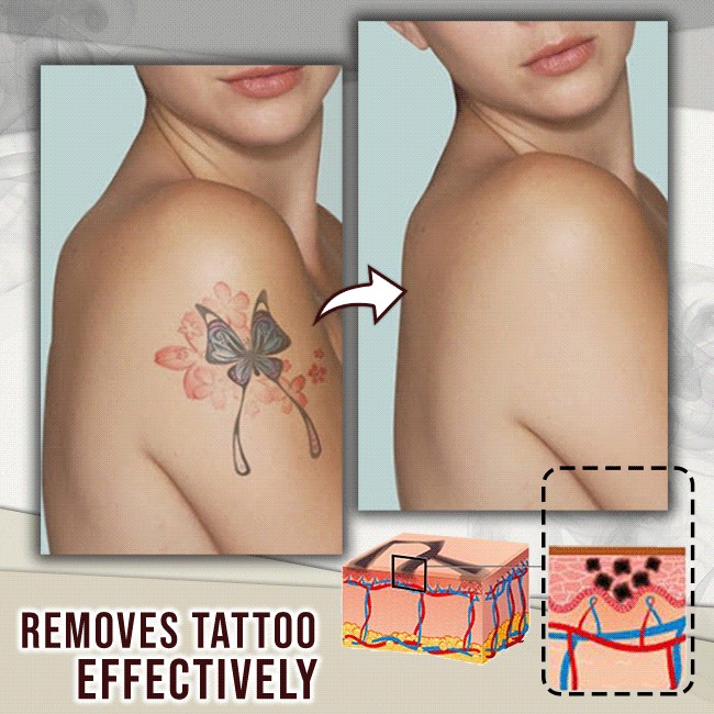 Us 28 98 Tattoo Removal Cream M Cccinlife Com