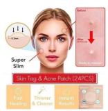 Skin Tag & Acne Patch ( 24 PCS )