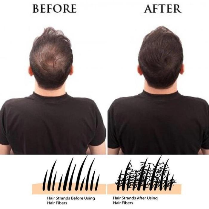 IMMETEE Hair Building Fibers For Thinning Hair