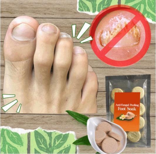 Anti-fungal Peeling Foot Soak