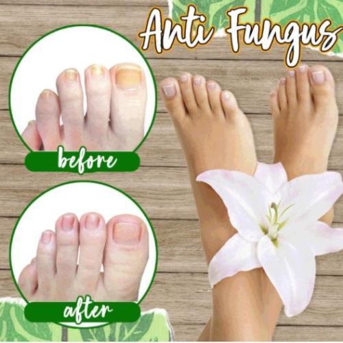 Anti-fungal Peeling Foot Soak