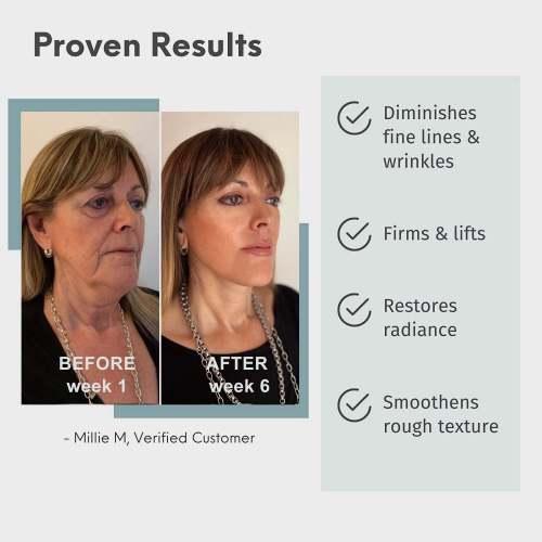 REN™ Advanced Collagen Boost Anti Aging Serum ⭐⭐⭐⭐⭐