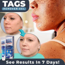 (🔥 Last day discount)Tags-Entferner-Gel-Wart Removal Cream