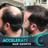 Alpha M Hair Regrowth Roller+Essence Set