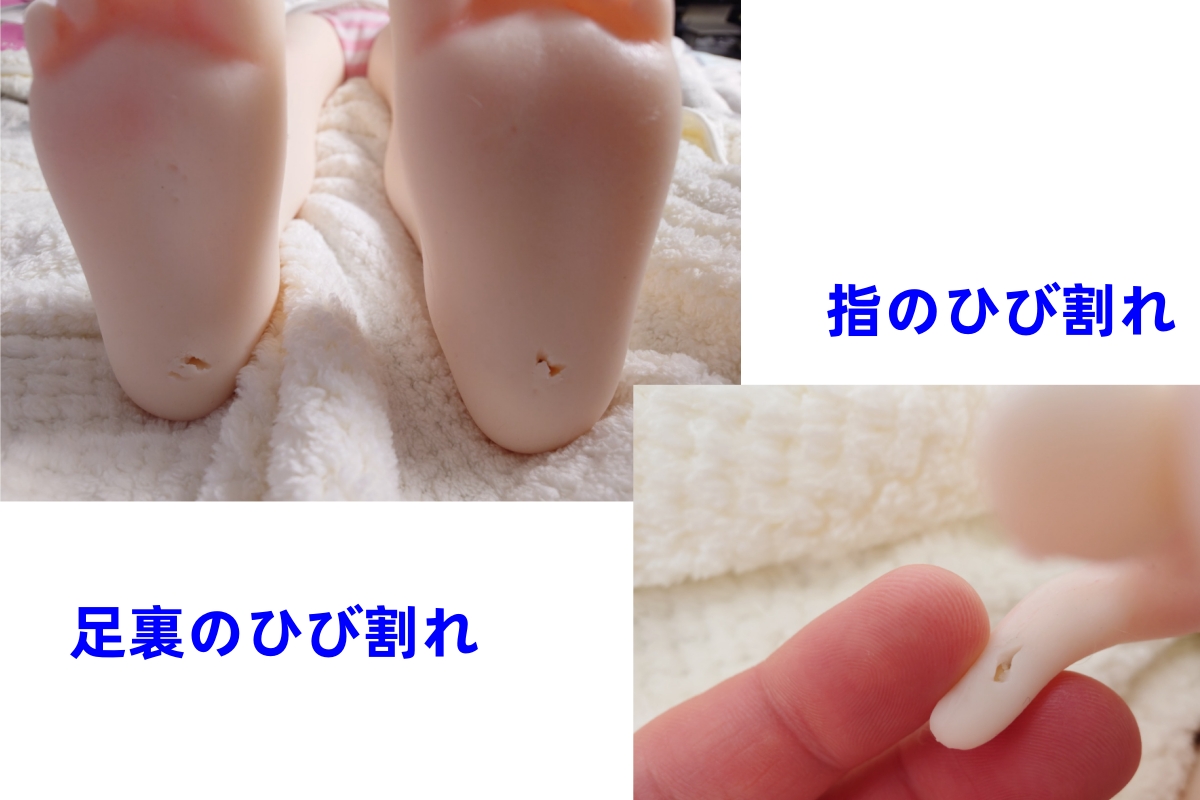 TPEシリコンラブドール指や足裏のひび割れ例