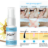 Painless Hair Inhibitor Spray (20 ML)