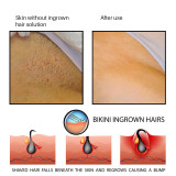 PANSLY Ingrown Hairs / Razor Bumps Solution Strawberry Legs Treatment（100ml）