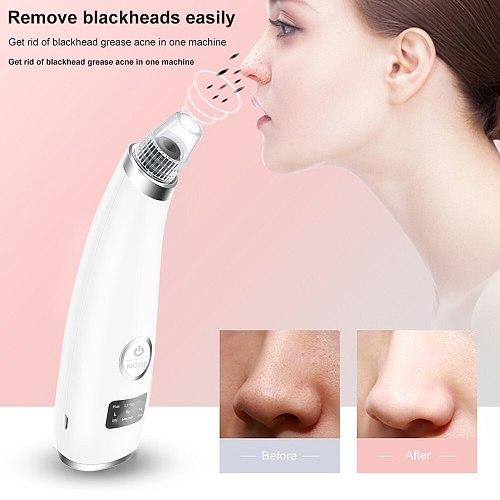 Electric Blackhead Remover Vacuum Heating Pore Cleaner Acne Blackdots Pimples Removal Diamond Beauty Tool Comedone Extractor