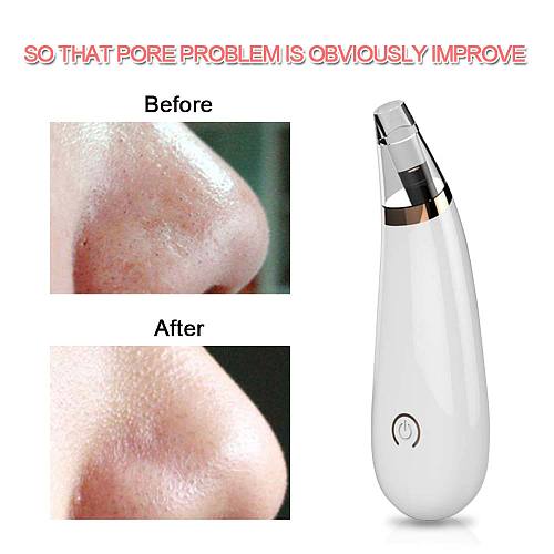 Blackhead Remover Face Deep Pore Cleaner Acne Pimple Blackdot Removal Vacuum Suction Facial SPA Diamond Beauty Skin Care Tools