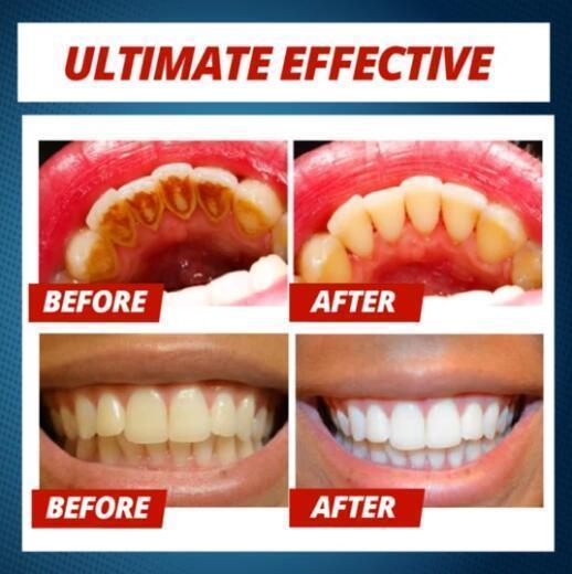 Natural Intensive Whitening Toothpaste