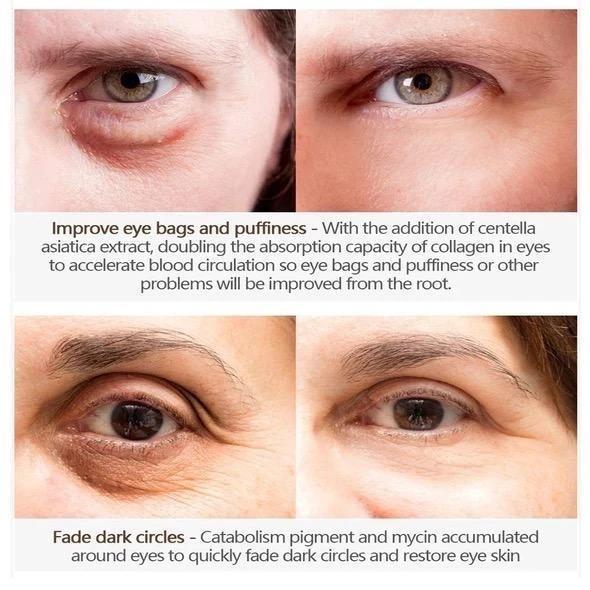 Magic Eye Cream - 28 seconds to remove eye bags/dark circles/eye wrinkles