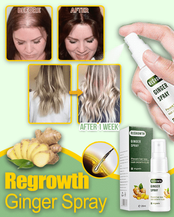 Anti-Hair Loss Spray(20ML)