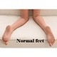 Normal feet