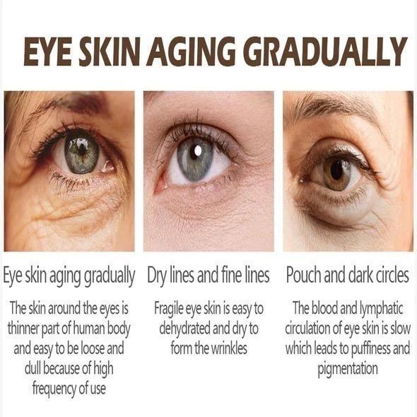 remove eye wrinkles instantly