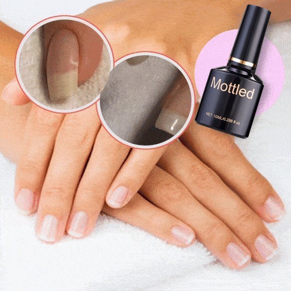 LAST DAY 49% OFF -2022 NAIL REPAIR PROTECTION GEL