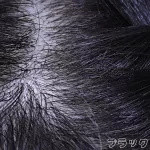 implanted hair -black