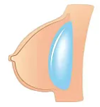 BCDOLL  76cm D.vaヘッド 小型ラブドール シリコン材質 ミニドール 5kg 塗装済みフィギュア セックス可能 ボディ選択可能