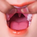 ROS（Real Oral Structure）
