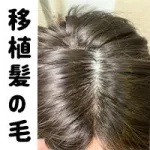 植毛