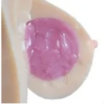 ゼリー胸（Jelly Breast / Gel Breast）