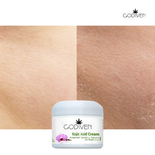 Pure Natural Low Moq silky Smooth Kojic Acid Hyaluronic Acid Collagen Amino Acid Private Label Organic Body Butter