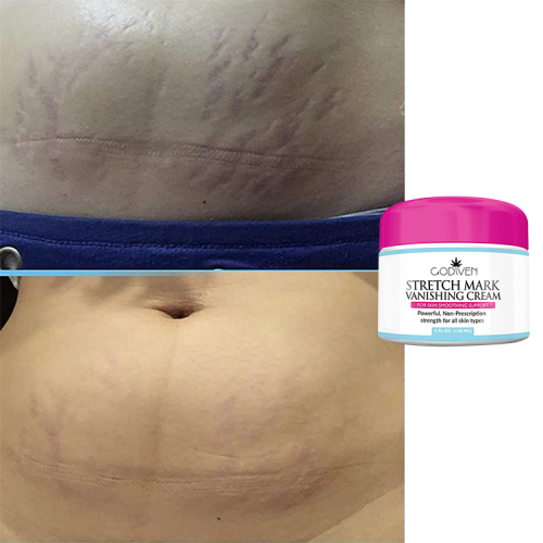 Copy Pure Natural Wholesale Unrefined Collagen Repair Goats Milk Hyaluronic Acid Aromherapy Gold Body Butter Shimmer