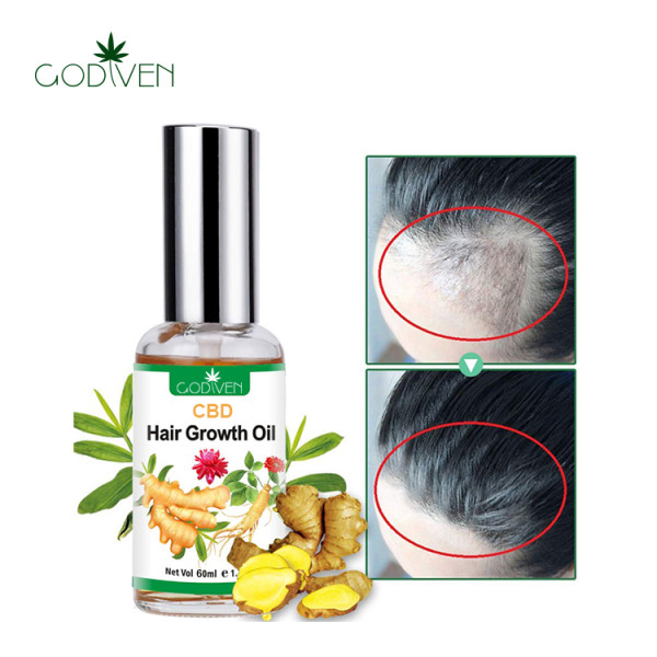 Best Selling Private Label CBD Terpene Ginseng Ginger Serum Private Label Organic Customise Hair Growth Oil