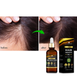 Best Perfect OEM ODM CBD Content Hair Serum For Growth Softee Hair Growth Oil For Hair Growth Fast Effect