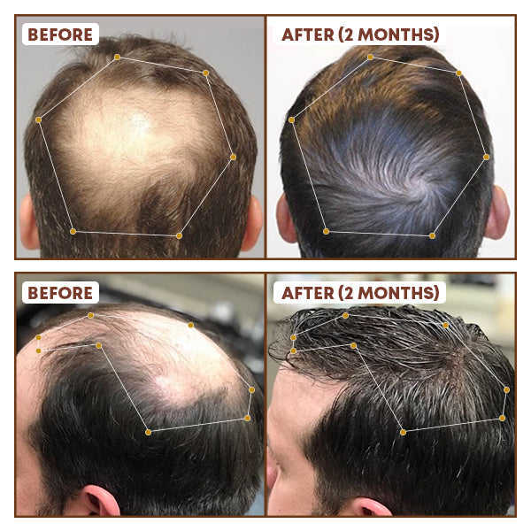 RestoreX Men's Hair Growth Serum