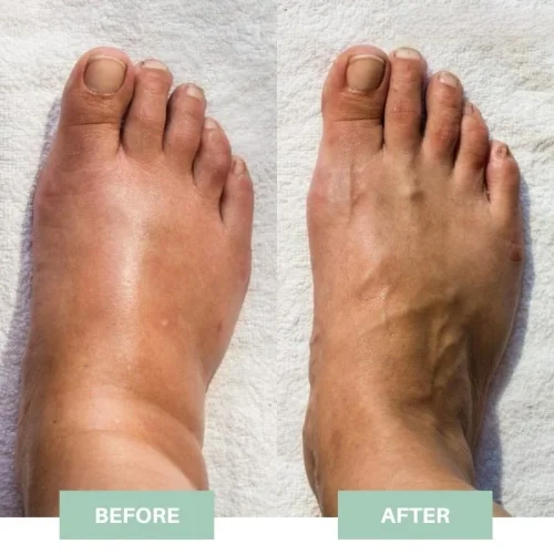 ❤️2023 New Promotion 50% OFF & Free Shipping❤️EMS Acupoints Stimulator Massage Foot Mat