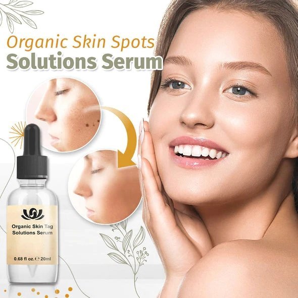 Organic Skin Spot Solutions Serum-[HOT SALE-45%OFF🔥]