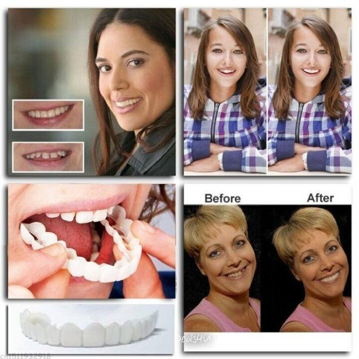 💝Last day discount-70%Off💝Latest👨‍⚕Adjustable Snap-On Dentures😁