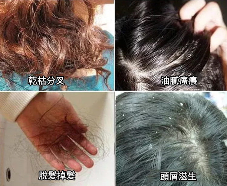 0a82185948921ac3 生薑何首烏養髮洗髮乳