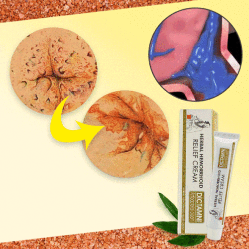 HUATUO™ Hemorrhoids Treatment Gel