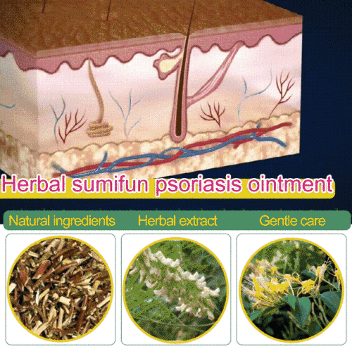 Sumifun Psoriasis Ointment