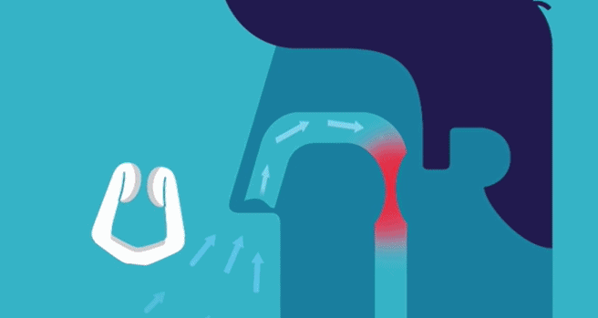 止鼾いびき防止磁気鼻呼吸クリップ