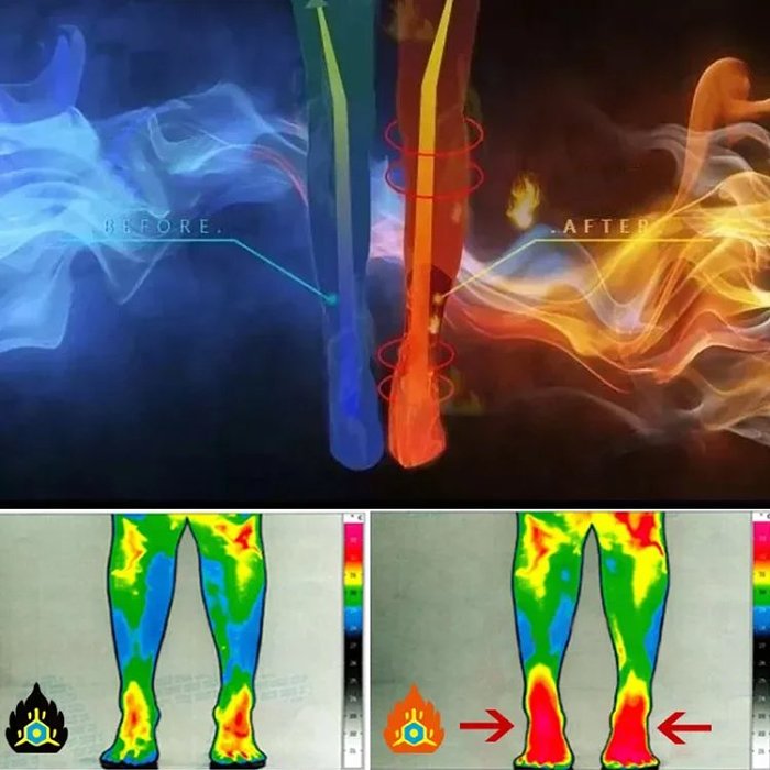【磁気治療発熱ソックス】5本指デザイン、抗菌、自発熱、通気性抜群、防臭