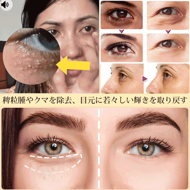 稗粒腫取りエッセンス、美容院に行かなくても、自宅で手軽にケアできる。