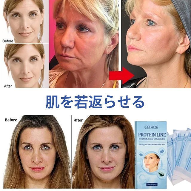 protein line タンパク質糸、Koreanの可溶性タンパク質の糸、Insta lifting 韓国のタンパク質の糸を持ち上げるセット (60PCS)