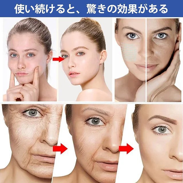タンパク質糸