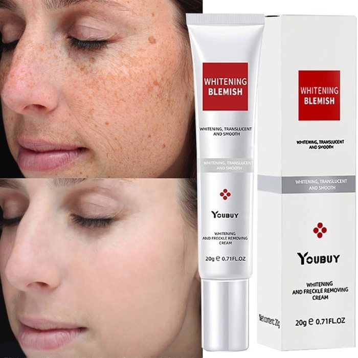 Whitening Anti-Freckle Moisturizing Cream