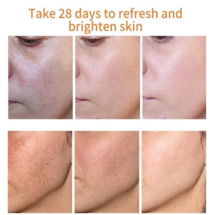 Whitening Anti-Freckle Moisturizing Cream
