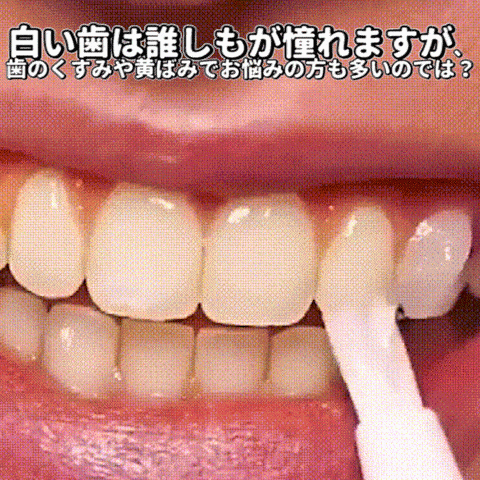 ホワイトニングジェル、塗るだけで、歯の黄ばみを解消！
