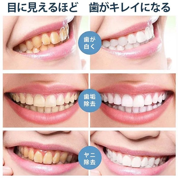 セルフホワイトニング剤 ホワイトニング、黄ばみ改善、トーンアップ、抗菌除臭、優しい処方、菌のバランスを維持